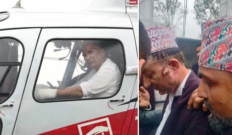 डिजिटल पानसको बत्ती बाल्दा अर्थमन्त्री घाइते