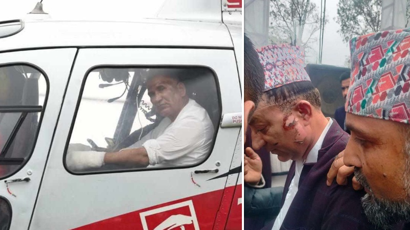 डिजिटल पानसको बत्ती बाल्दा अर्थमन्त्री घाइते