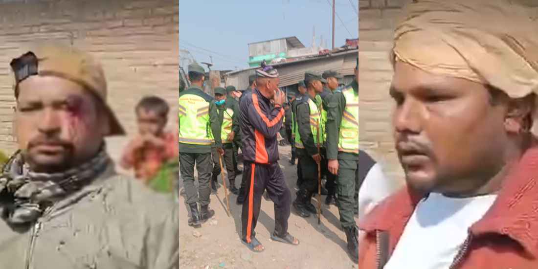 काठमाडौं महानगरको डोजर टेकुको कबाडी गोदाममा, ३ मजदुरमाथि हातपात