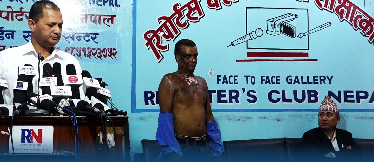 गौरीशंकरको आलमले जिउदै मानिसलाई इट्टाभट्टामा पोलेका हुन्, कडाभन्दा कडा सजाय दिनुपर्छ
