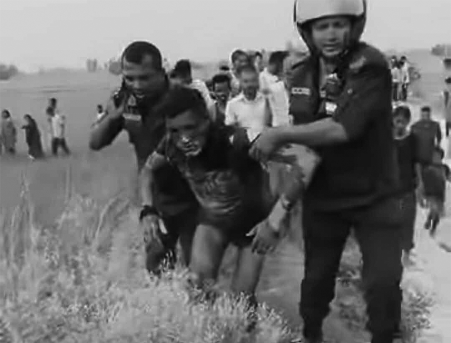 रौतहटमा रुबी हत्याका आरोपी शरीर जलेको अवस्थामा प्रहरी नियन्त्रणमा